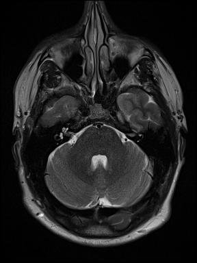 2021 MRI.8731.8736.873164.jpg